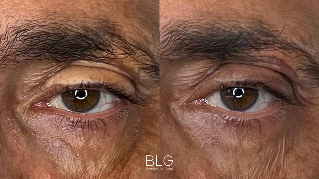 barbara-la-gatta_primae-dopo_1