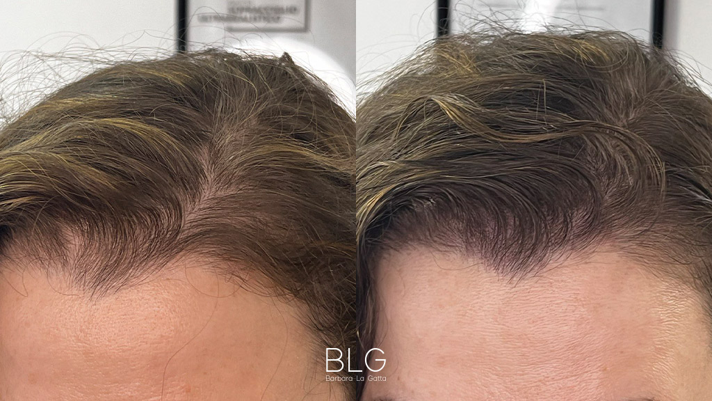 barbara-la-gatta_primae-dopo_14