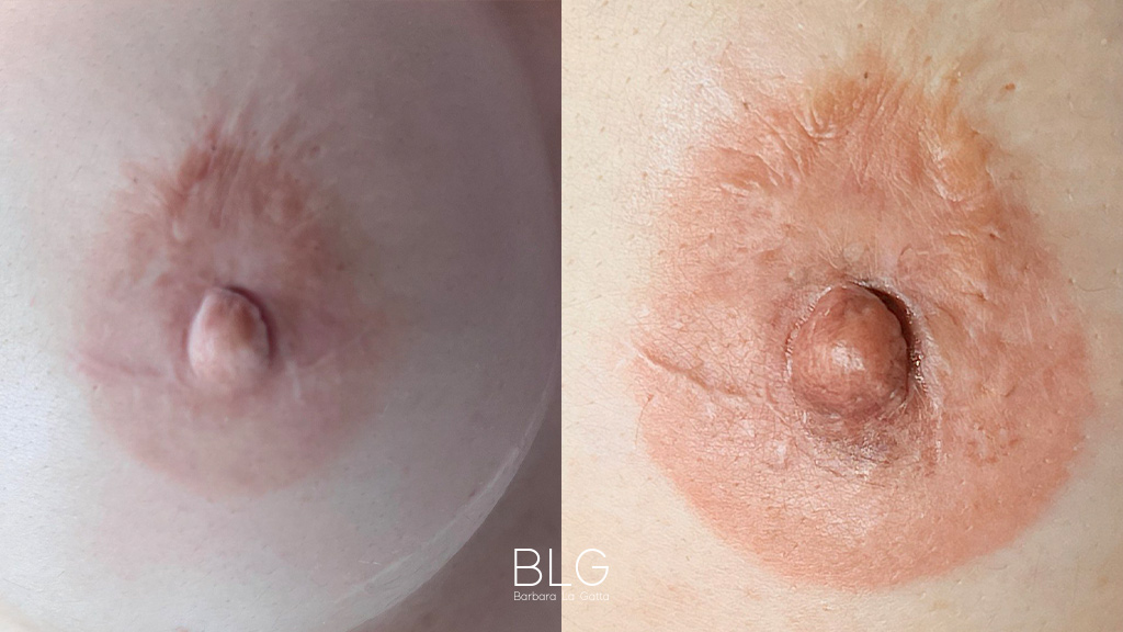 barbara-la-gatta_primae-dopo_18