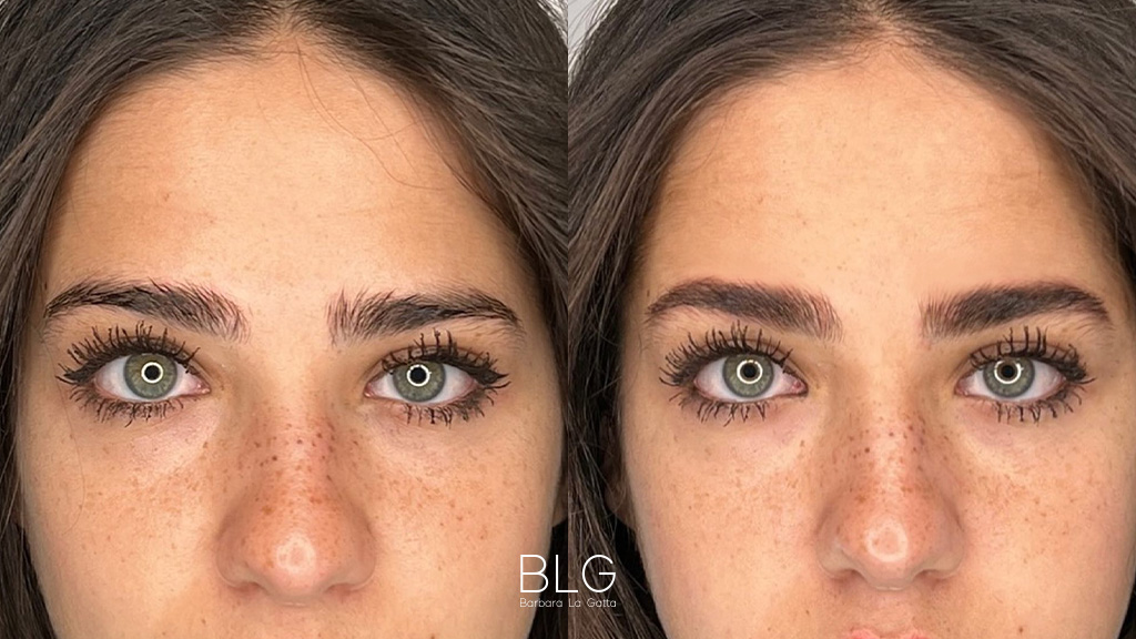 barbara-la-gatta_primae-dopo_21