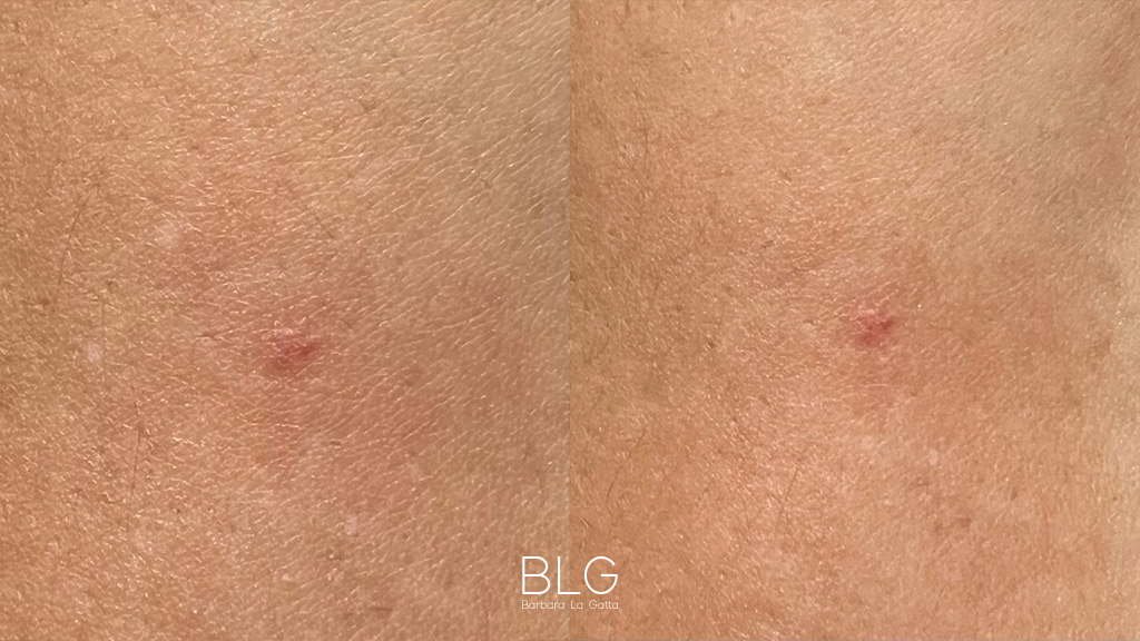 barbara-la-gatta_primae-dopo_22