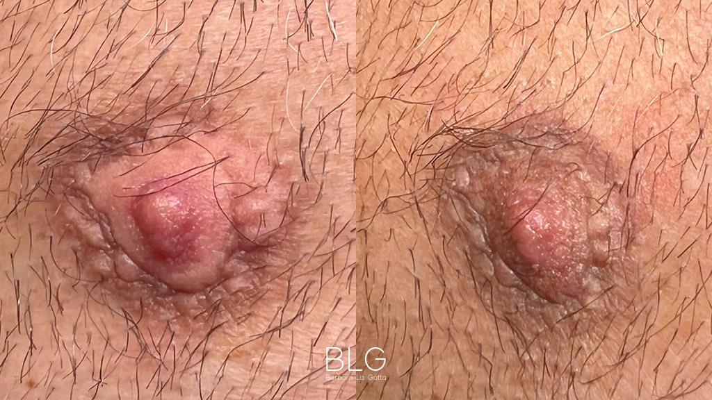 barbara-la-gatta_primae-dopo_24