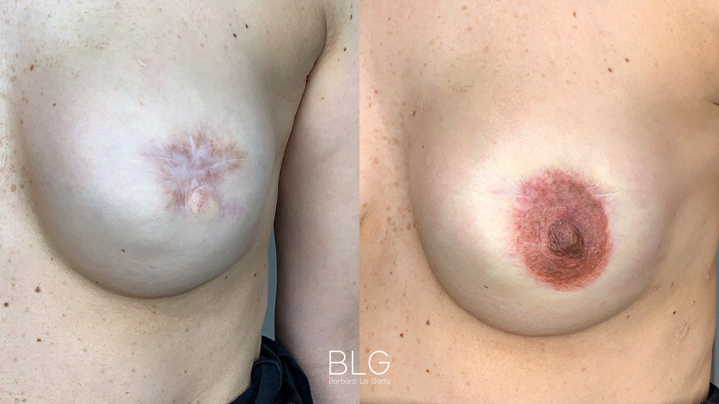 barbara-la-gatta_primae-dopo_3