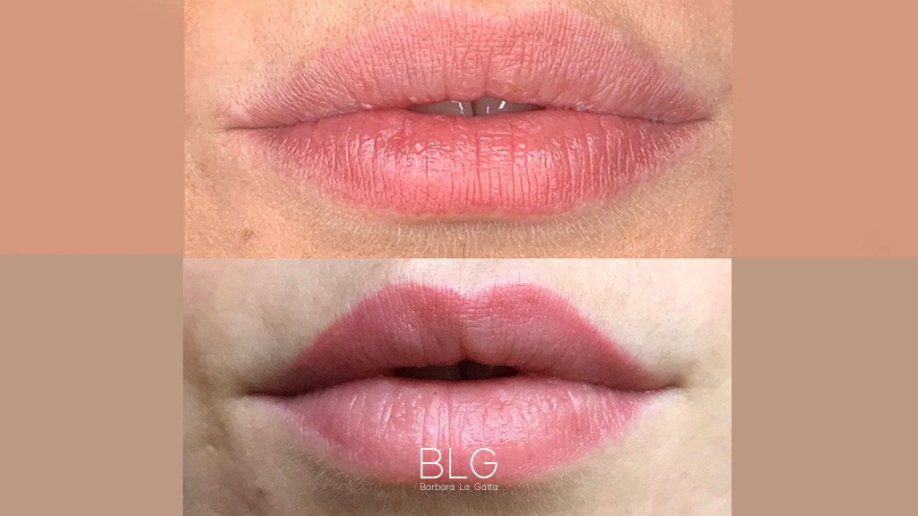 barbara-la-gatta_primae-dopo_4