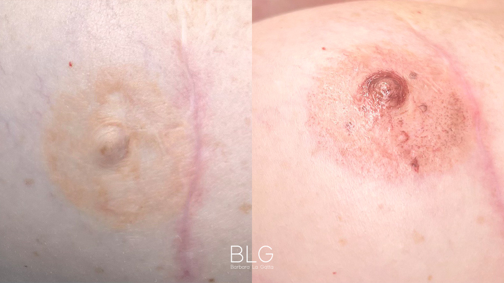 barbara-la-gatta_primae-dopo_5